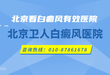 北京白癜风专科医院医生-大面积白癜风治疗方法及