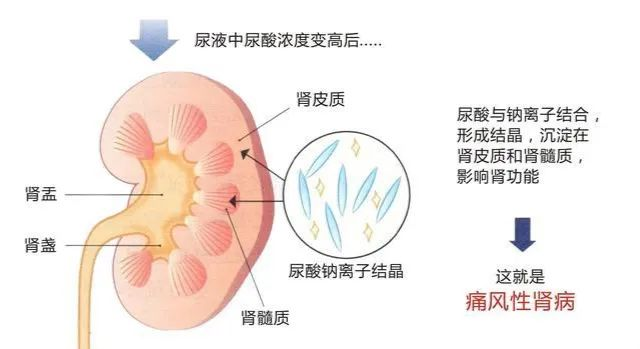 父亲节┃2022 夏季痛风准确治疗学术交流会在贵阳强直医院举办