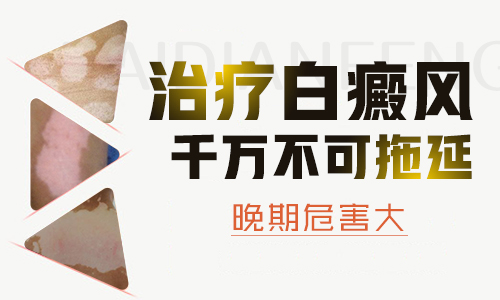 石家庄专治白癜风医院前十排名公布-白癜风不及时治疗会怎么样