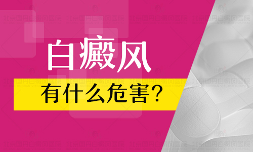 邢台看白癜风的医院怎么样-白癜风会对孩子产生什么影响