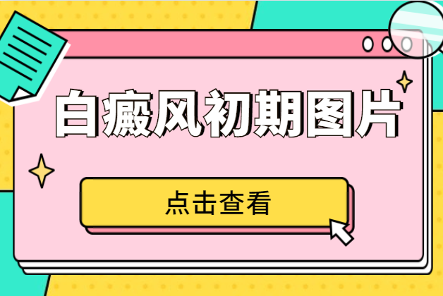 郑州西京白癜风医院究--好不好，郑州哪家白癜风医院治疗的好