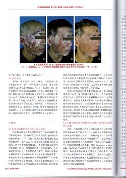 白癜风的治疗不仅是需要内调更需要外治！#海南白癜风医院