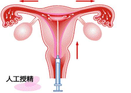 郑州天伦不孕医院-子宫内膜多少适合怀孕？