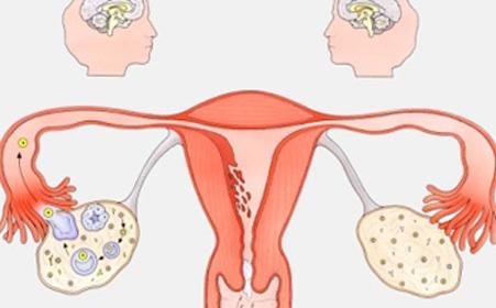 郑州治疗多囊哪个医院好?备孕排卵期注意事项