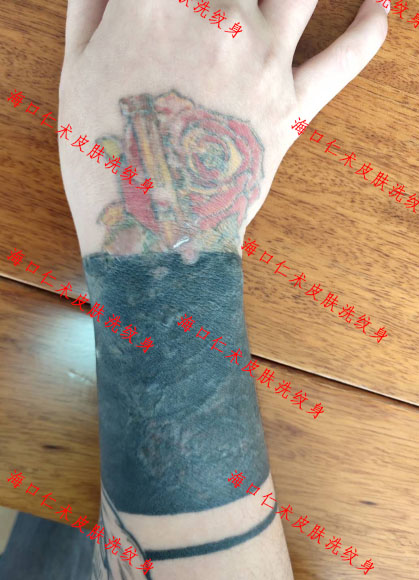 海口在哪能洗纹身？洗纹身很疼吗？一般用什么方法清洗效果好