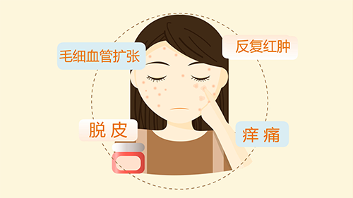 医用抗过敏成品面膜治疗激素皮炎有用吗？海口皮肤病医院哪家好？