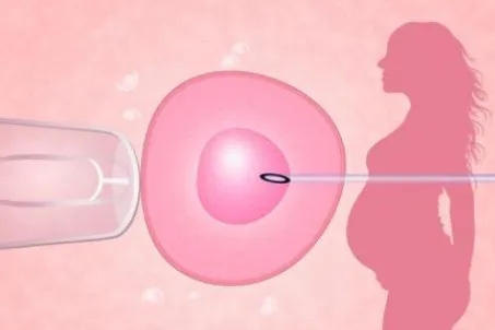 河南不孕不育医院-多囊卵巢综合征有哪些危害？
