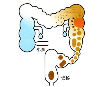 北京丰益肛肠医院