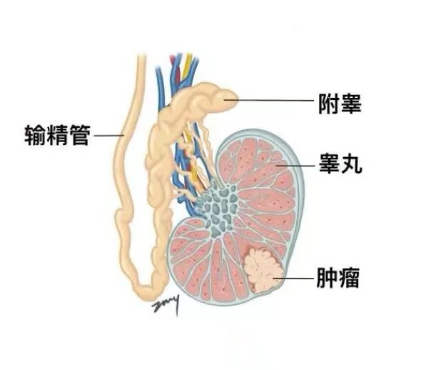 来看看你是不是属于湿气重，引起的阳痿早泄！