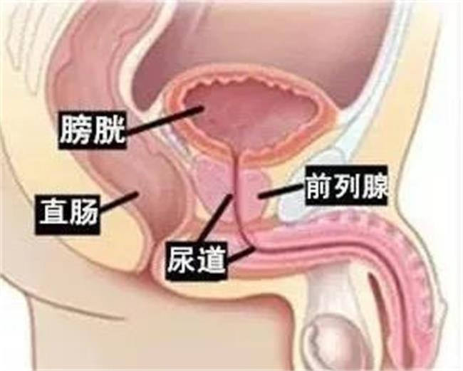 得了“慢性前列腺炎”羞于启齿？听听中医治疗有什么妙招