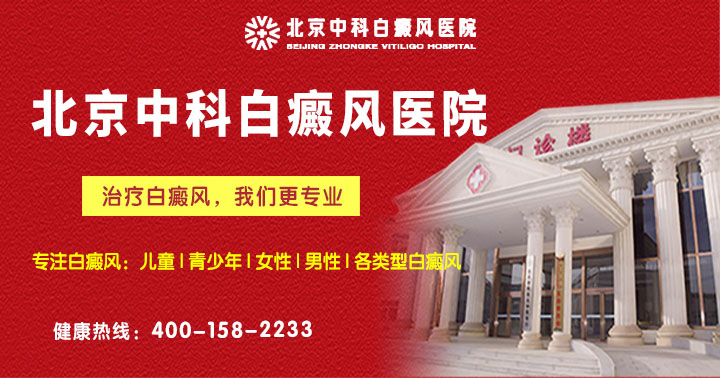 北京中科白癜風醫院