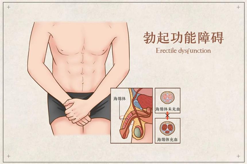 困扰80%男性的男科疾病，你中招了没？中医治疗有妙方！