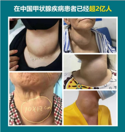 通知：7月15-16日（本周末），昆明中研甲状腺医院即将举办联合会诊活动
