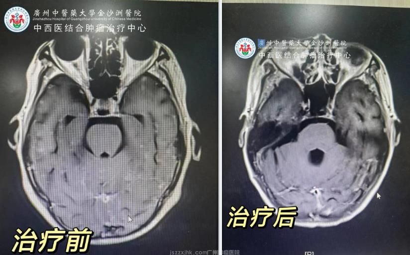 360截组合.jpg