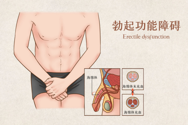 男人必看！晨勃消失，意味着「性无力」？