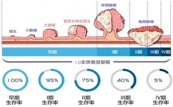 肠息肉老拉肚子，中了这几条你就危险了！