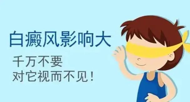 白癜风不痛不痒可以不用治疗吗？