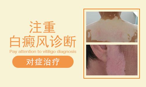 筛选：「南昌白癜风医院排名」白癜风患者的基本诊断方法？
