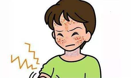 银屑病必不可少的看诊检查,这些知识一定要了解-长春肤康医院-全民健