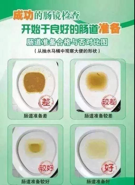 肠镜准备怎样才算干净图片