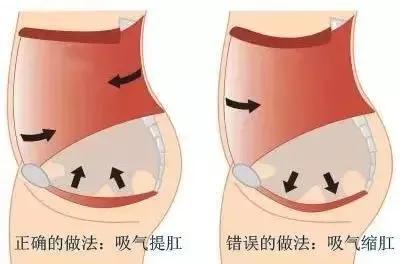 脱肛的症状及治疗方法图片