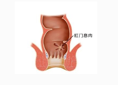 健康肛门 正常图片