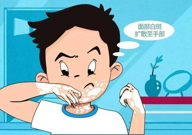 排名公布：南昌白癜风医院排名靠前十强名单今日官宣，该如何有效治疗好白癜风呢?