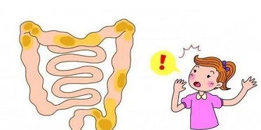 北京肠息肉切除随访 哪几类肠息肉容易癌变？