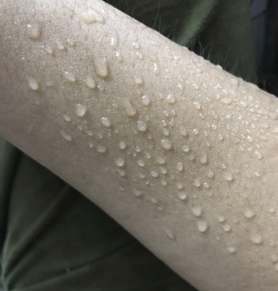 解码手足出汗如潮：肾合能量失调，你真的了解多少？