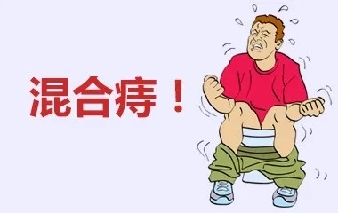 北京的痔疮医院哪家好？痔疮——从识别到巩固的全数指南！