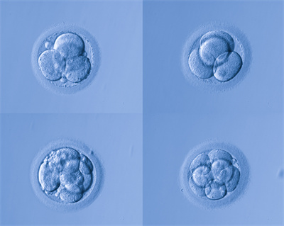 體制內(nèi)家庭能否赴美試管？危險(xiǎn)何在？