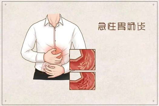 治结肠炎北京医院哪家好？急性结肠炎该怎么办？