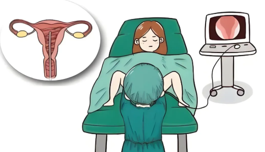 宫腔镜检查需要麻痹吗