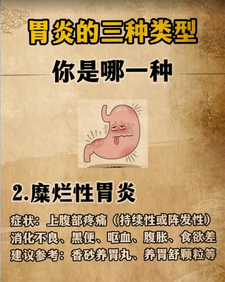 胃炎常见的三种类型，你属于哪一种？我告诉你怎么治！