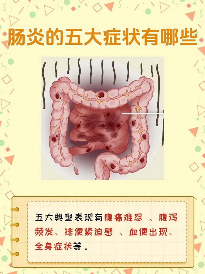 腸炎常見哪些癥狀？應該怎么進行治療，今天就為您講清楚：