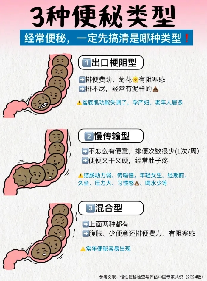 常見(jiàn)的慢性功能性便秘有3種，先弄清楚是哪種情況！