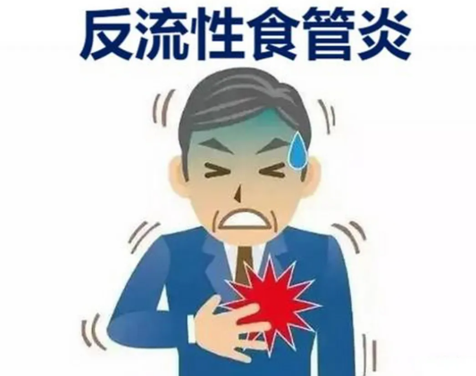 盖胃平治反流性食管炎吗