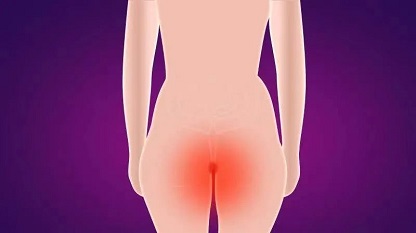 北京治肛裂哪家醫(yī)院好？盤點肛裂和痔瘡的相似點&不同點！