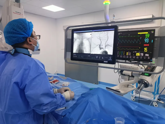 腦血管造影是手術嗎