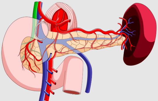 腹腔鏡下胰體尾切除術(shù)