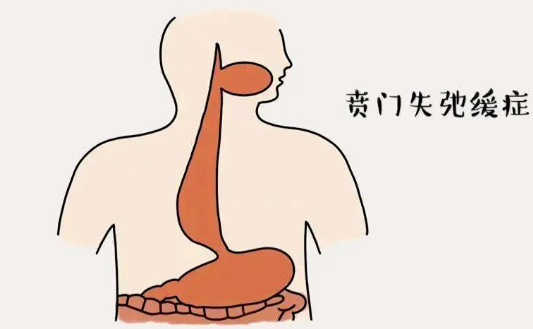 賁門失弛緩癥早期癥狀