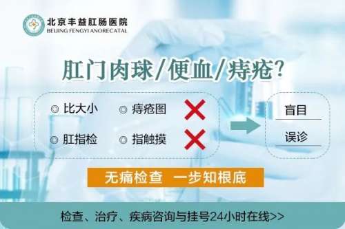  北京治肛周濕疹哪家醫(yī)院好？這4個肛周濕疹的誤區(qū)，你中招了嗎？