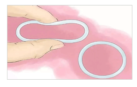 取環(huán)什么時(shí)候取合適