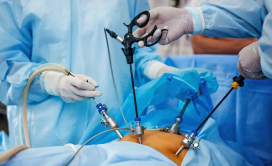 腹腔鏡微創(chuàng)手術(shù)怎么做