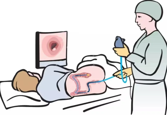 腸鏡不檢查小腸嗎